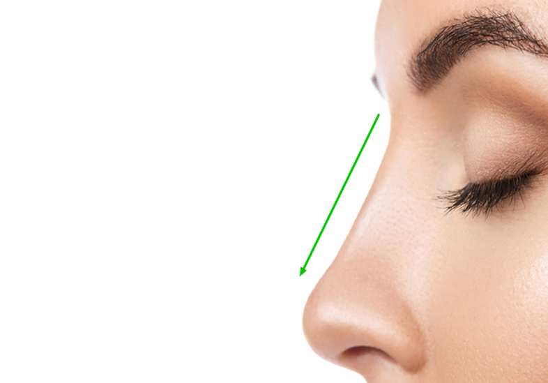 بعد-از-جراحی-بینی