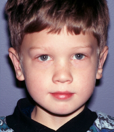 بعد-جراحی-گوش