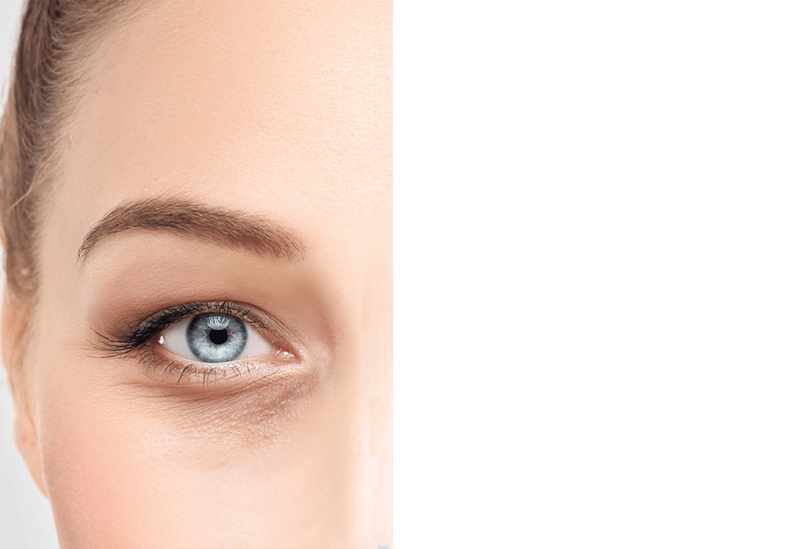 قبل-جراحی-پلک