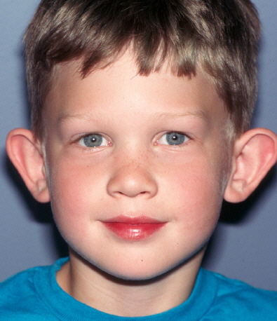 قبل-جراحی-گوش